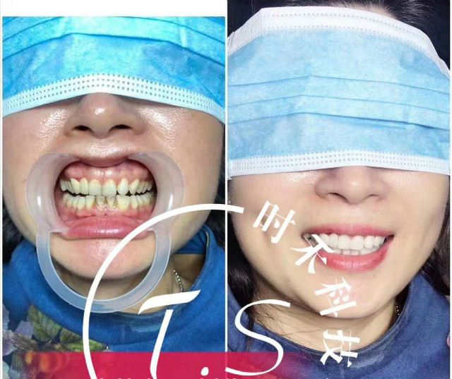優(yōu)秀作品