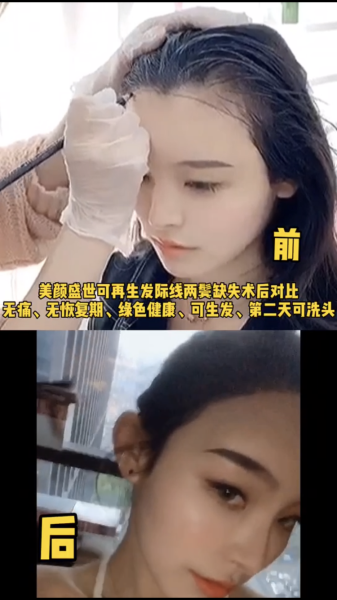 再生發(fā)效果展示四