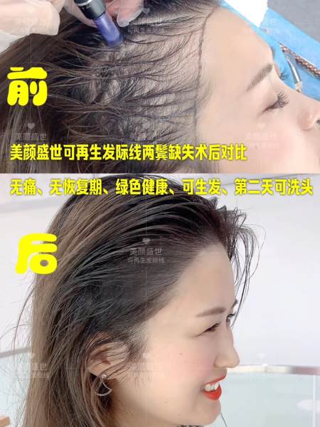 再生發(fā)效果展示二