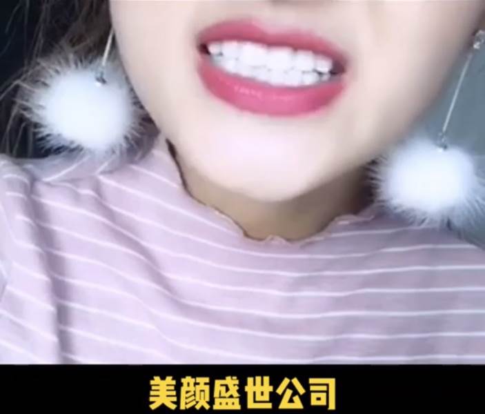 美牙效果展示五