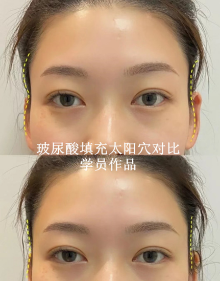學(xué)員作品一