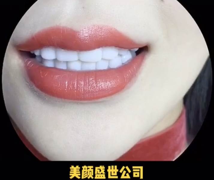 美牙效果對比一