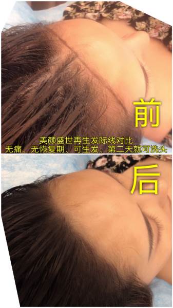 再生發(fā)效果對比三
