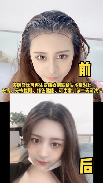 再生發(fā)效果對比二