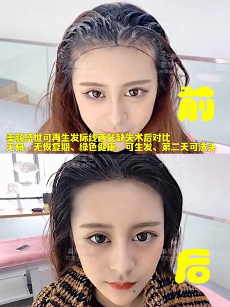 再生發(fā)效果對比四